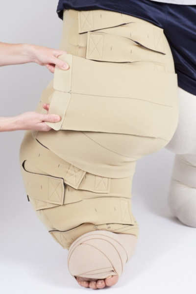 Circaid Reduction Kit, Lobe