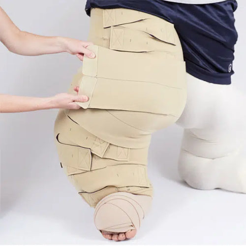 Circaid Reduction Kit, Whole Leg with Lobe