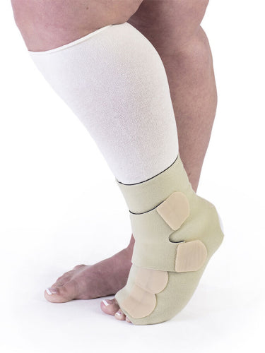 Lymphedema patient wearing the Compreflex Reduce Foot in the color beige